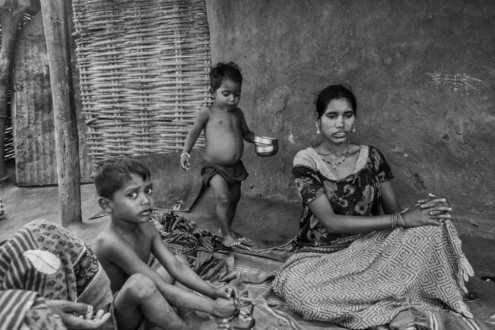 Malnutrition stalks India’s children 11